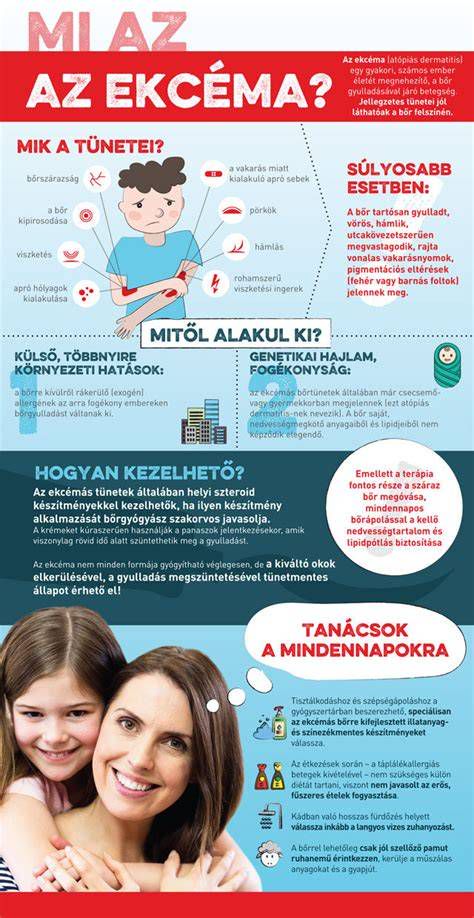 Az átugrott vezérlés tünetei infografika